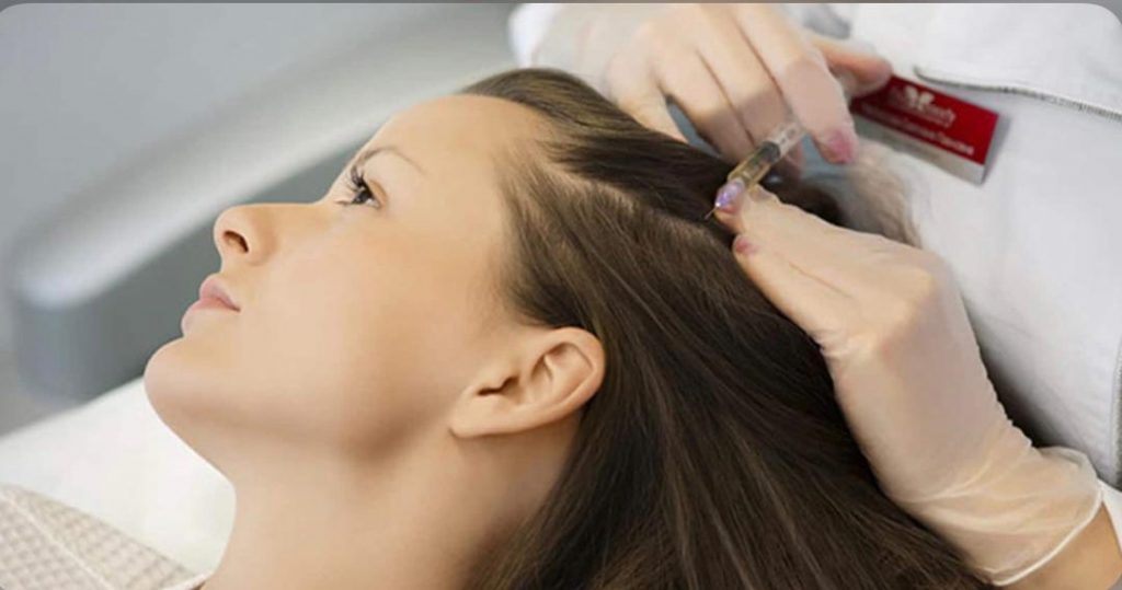 مزوتراپی موهای سر