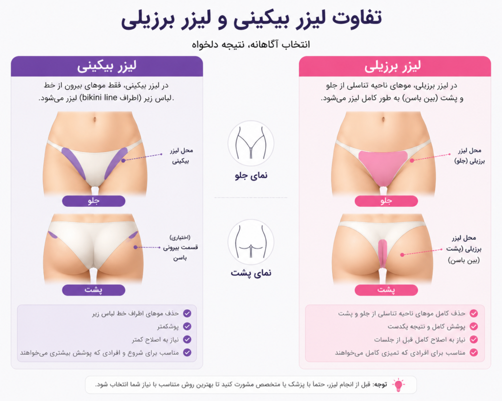 تفاوت لیزر بیکینی و لیزر بزریلی