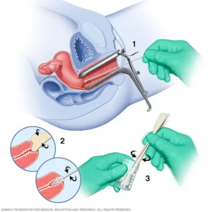 hpv و سرطان دهانه رحم